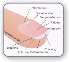 Fingernail Health – Some indicators of what your nails are telling you! Click he