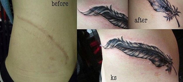 Making the most out of a scar #ink #Tattoo #Art