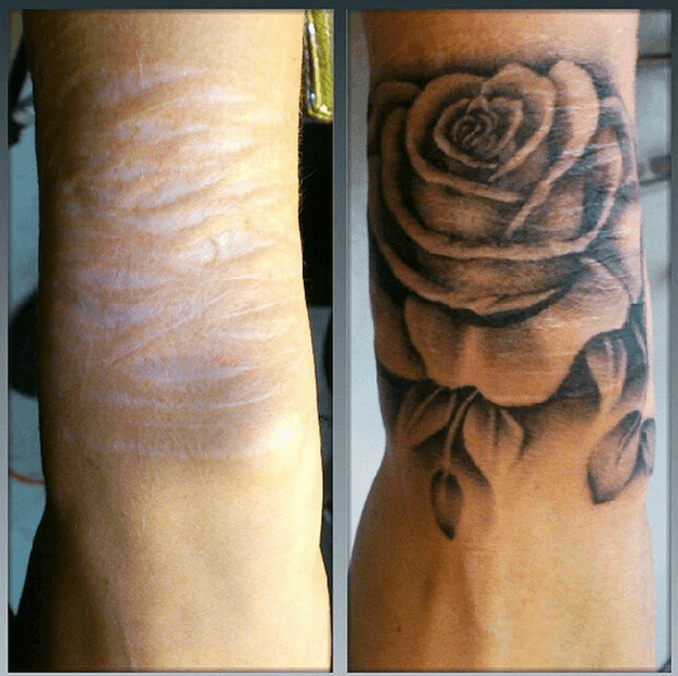 Making the most out of a scar #ink #Tattoo #Art