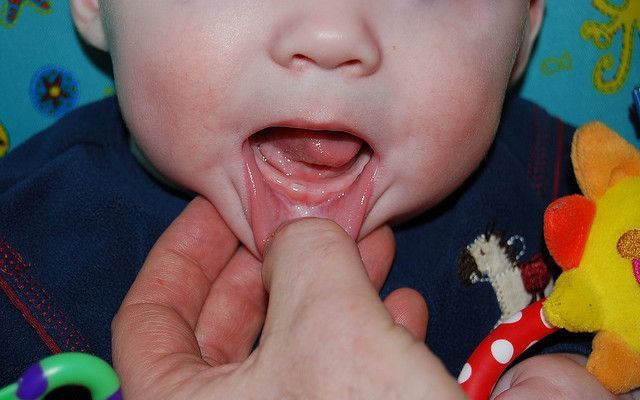 Homeopathy 101: Remedies For Teething, Separation Anxiety and More! | The Mommyp
