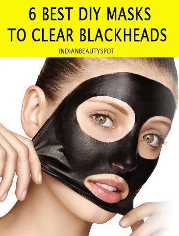 Blackheads Mask to deep clean pores