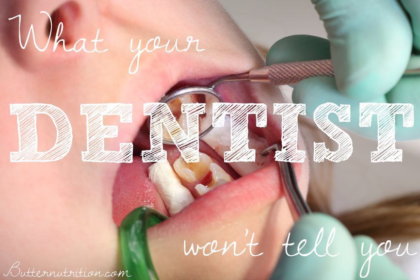 Got cavities? What your den