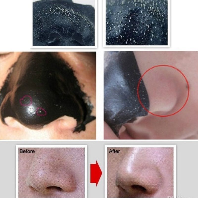 Blackheads are those nasty little things we all hate to have and try to remove as quickly as possible in order to enjoy a beautiful face and skin. There are several methods you can use to get rid of