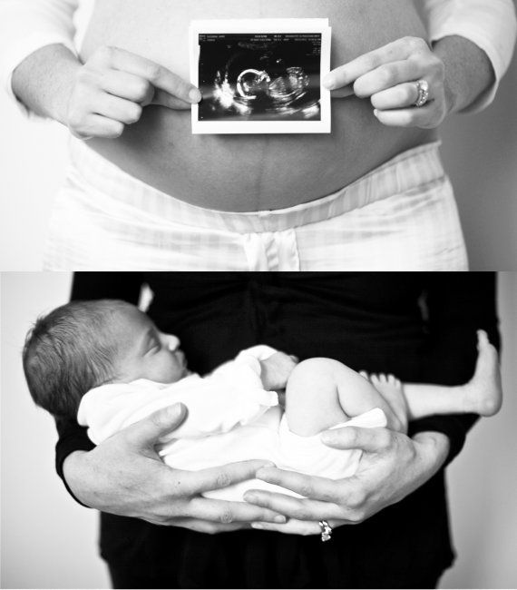 11 beautiful before & after maternity photos | BabyCenter Blog,  Better hurry up and get the
