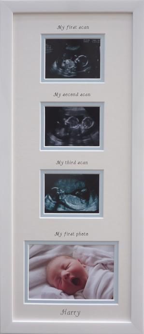 Triple baby scan and My first photo – personalise with a name for new baby boy.