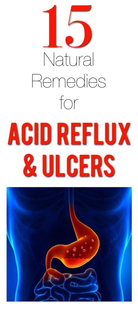 15 Natural remedies for the treatment of acid reflux and ulcers