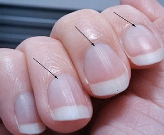 Blue Nail Base -   Life-saving warnings your nails are sending