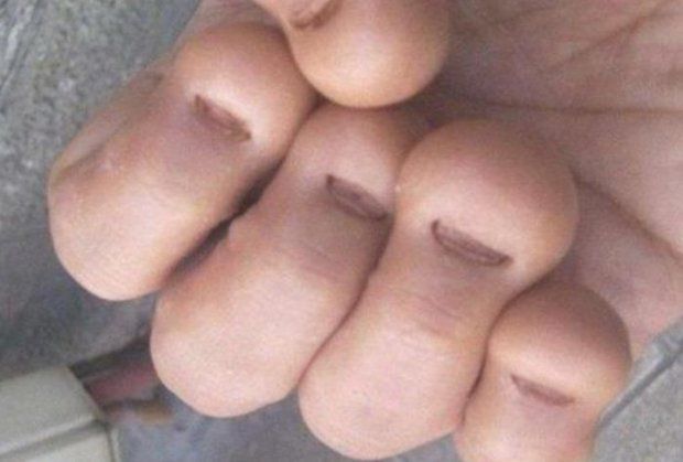Blue Nail Base -   Life-saving warnings your nails are sending