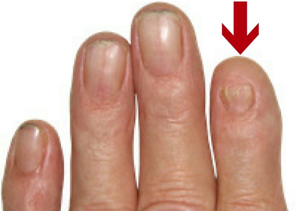Life-saving warnings your nails are sending