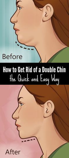 How to Get Rid of a Double Chin the Quick and Easy Way