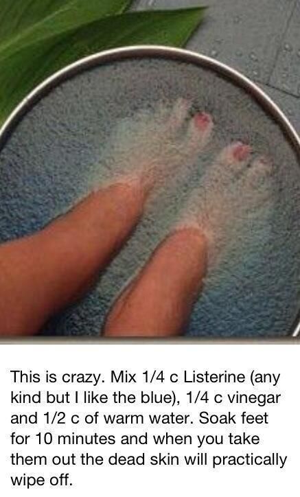 To get dead skin off your feet.