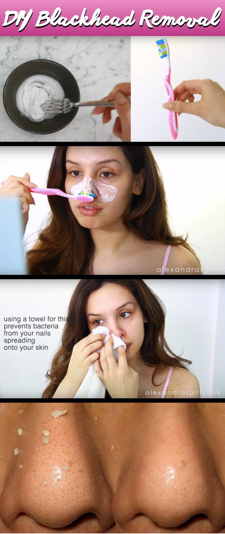 How She Gets Rid Of Her Blackheads With a DIY Mask and Toothbrush is Simply Amazing -   24 diy face black heads
 ideas