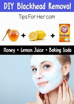 DIY Blackhead Removal - An insanely easy tip to remove black heads. All you need is 3 items you probably already have in your kitchen. -   24 diy face black heads
 ideas