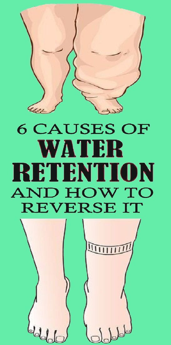 6 Simple Ways to Reduce Water Retention -   23 fitness legs health
 ideas