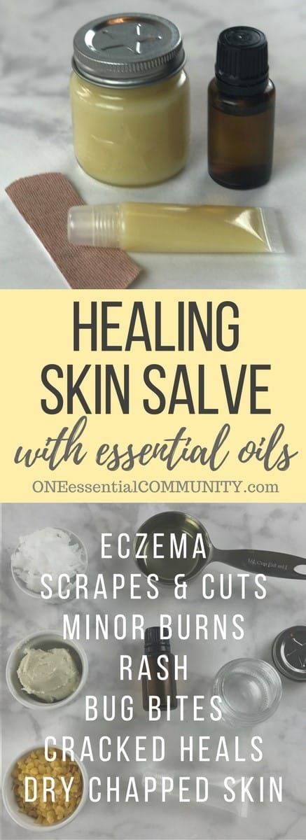Essential Oil Healing Salve -   22 anti inflammatory salve
 ideas