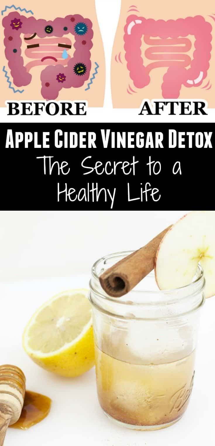 Apple Cider Vinegar Detox: The Secret to a Healthy Life -   20 best detox diet
 ideas