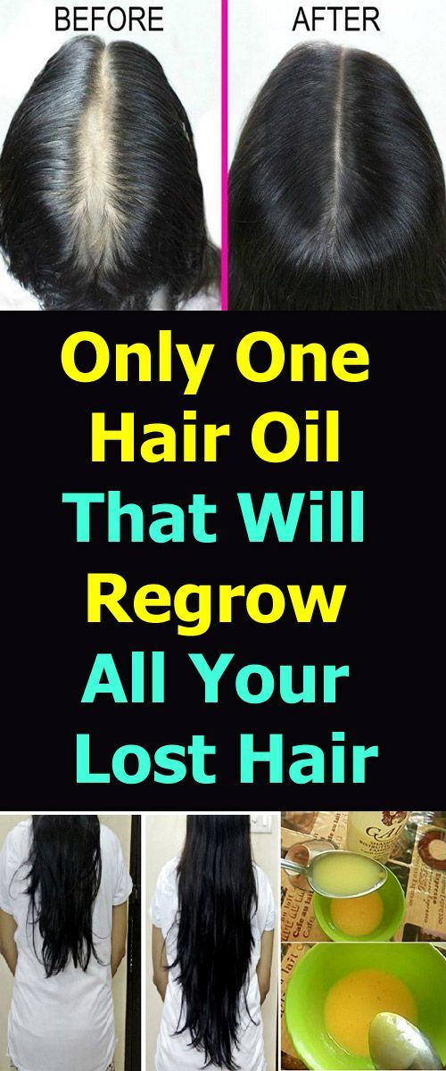 One Hair Oil That Will Regrow All Your Lost Hair! -   17 hair Natural look
 ideas