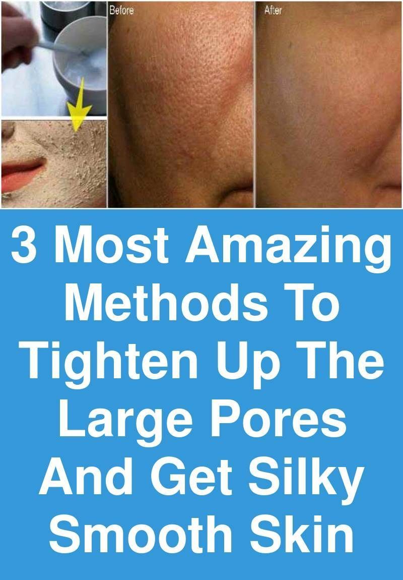 3 Most amazing methods to tighten up the Large pores and get silky smooth skin -   14 skin care Pores beauty secrets ideas