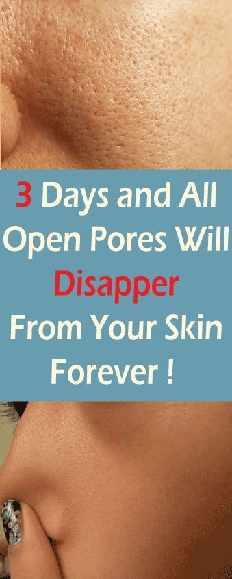 How To Make Pores Disappear With Only 1 Ingredient Naturally -   14 skin care Pores beauty secrets ideas