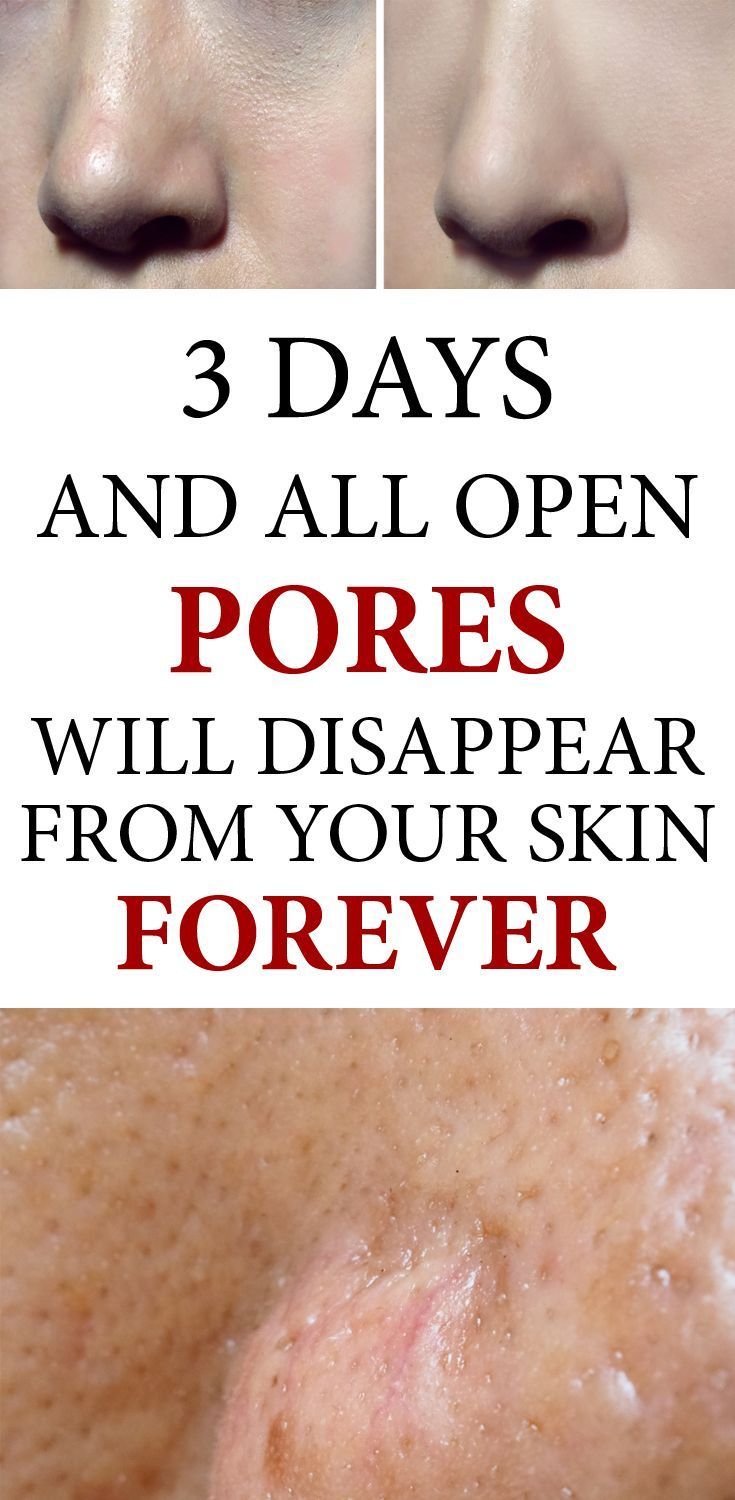 3 Days and All Open Pores Will Disappear from Your Skin Forever -   14 skin care Pores beauty secrets ideas