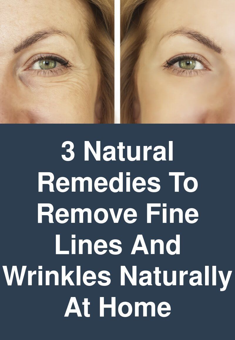 3 Natural remedies to Remove fine lines and wrinkles naturally at home -   16 skin care For Wrinkles people ideas