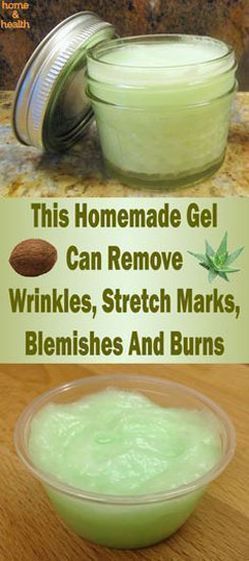 This Homemade Gel Can Remove wrinkles & Stretch marks, blemishes and burns -   16 skin care For Wrinkles people ideas
