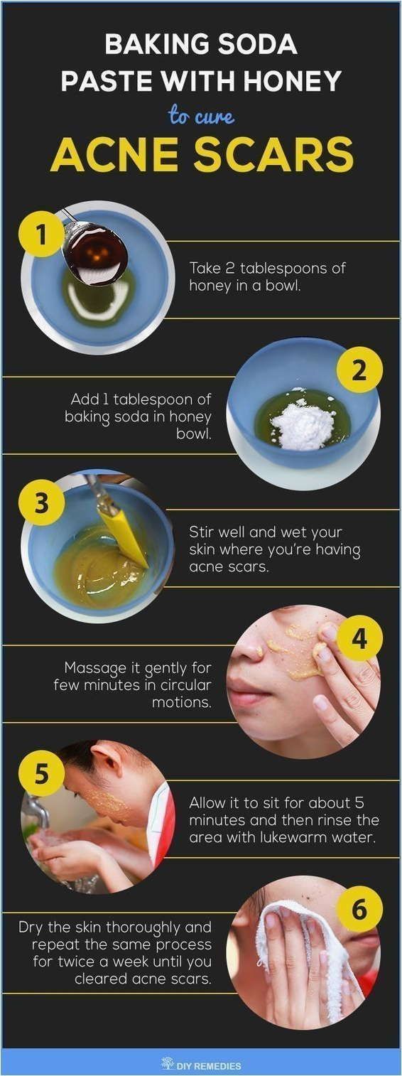 Basic Skin Care Tips That Everyone Should Be Using -   9 skin care Acne how to get rid ideas
