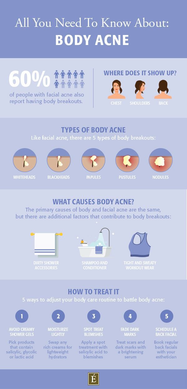 Body Acne: How To Get Rid Of Breakouts On Your Back, Chest & Shoulders -   9 skin care Acne how to get rid ideas