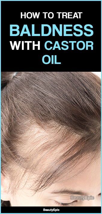 How to Treat Baldness with Castor Oil? -   14 good hair Tips ideas
