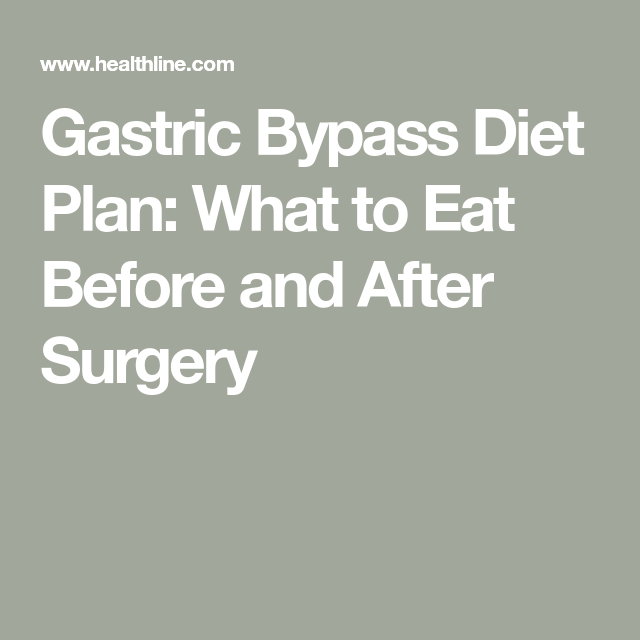 Gastric Bypass Diet Plan: What to Eat Before and After Surgery -   15 diet Before And After eating plans ideas
