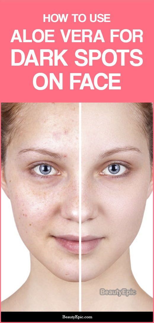 How to Use Aloe Vera to Remove Dark Spots on Face? -   16 makeup Face aloe vera ideas