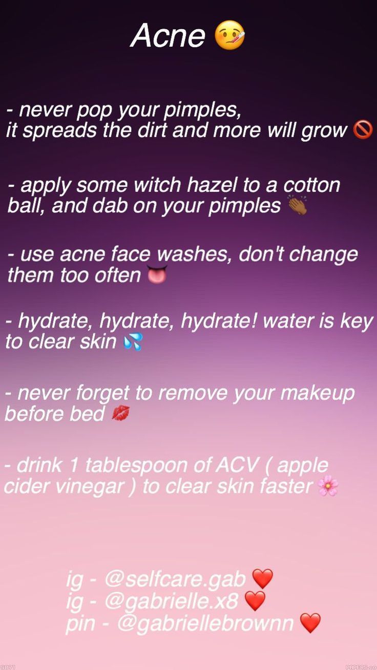 Like what you see? Follow me Amber Johnson.ddyy for more #SkinCarePimplesHomeRem -   8 skin care Remedies life ideas