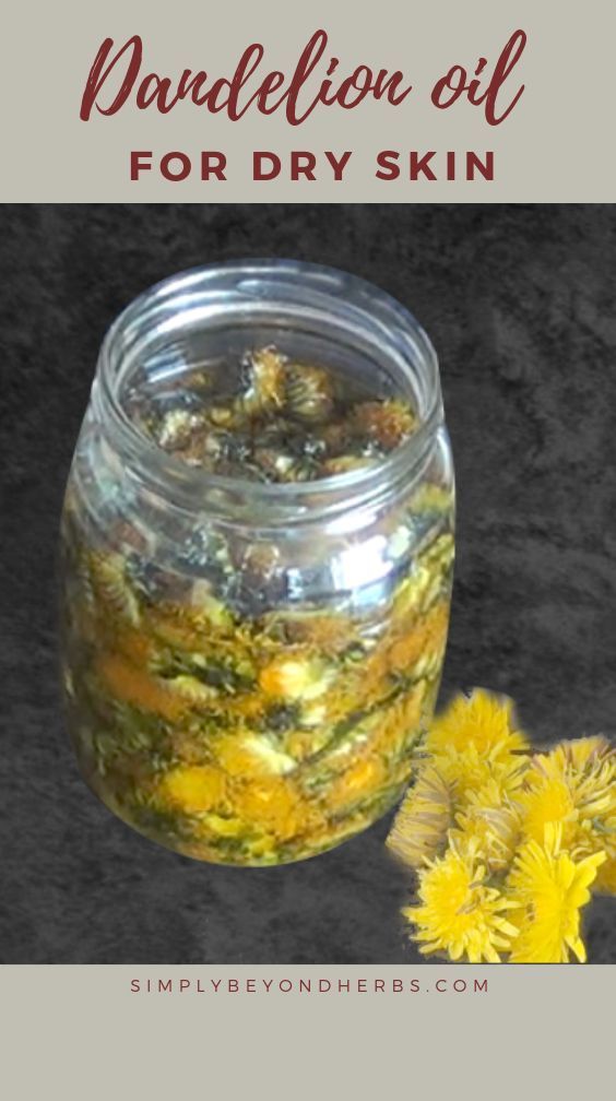 DIY Dandelion oil to heal your cracked hands -   8 skin care Remedies life ideas