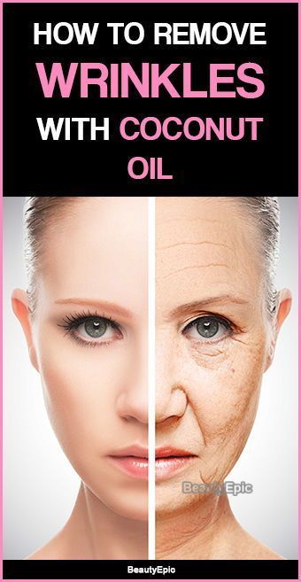 How to Remove Wrinkles with Coconut Oil? -   12 skin care Redness coconut oil ideas