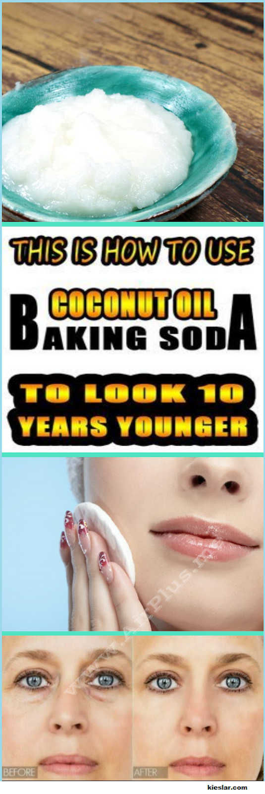 How To Use Coconut Oil And Baking Soda To Look 10 Years Younger -   12 skin care Redness coconut oil ideas