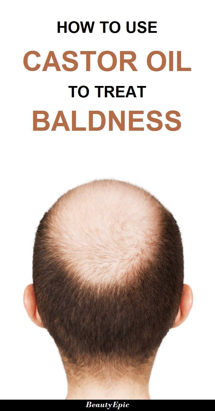 How to Treat Baldness with Castor Oil? -   12 hair Growth for men ideas