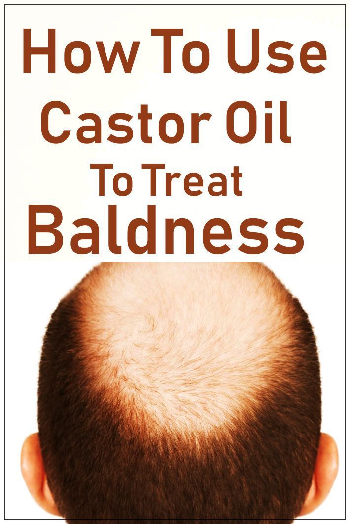 How To Treat Baldness With Castor Oil? -   12 hair Growth for men ideas