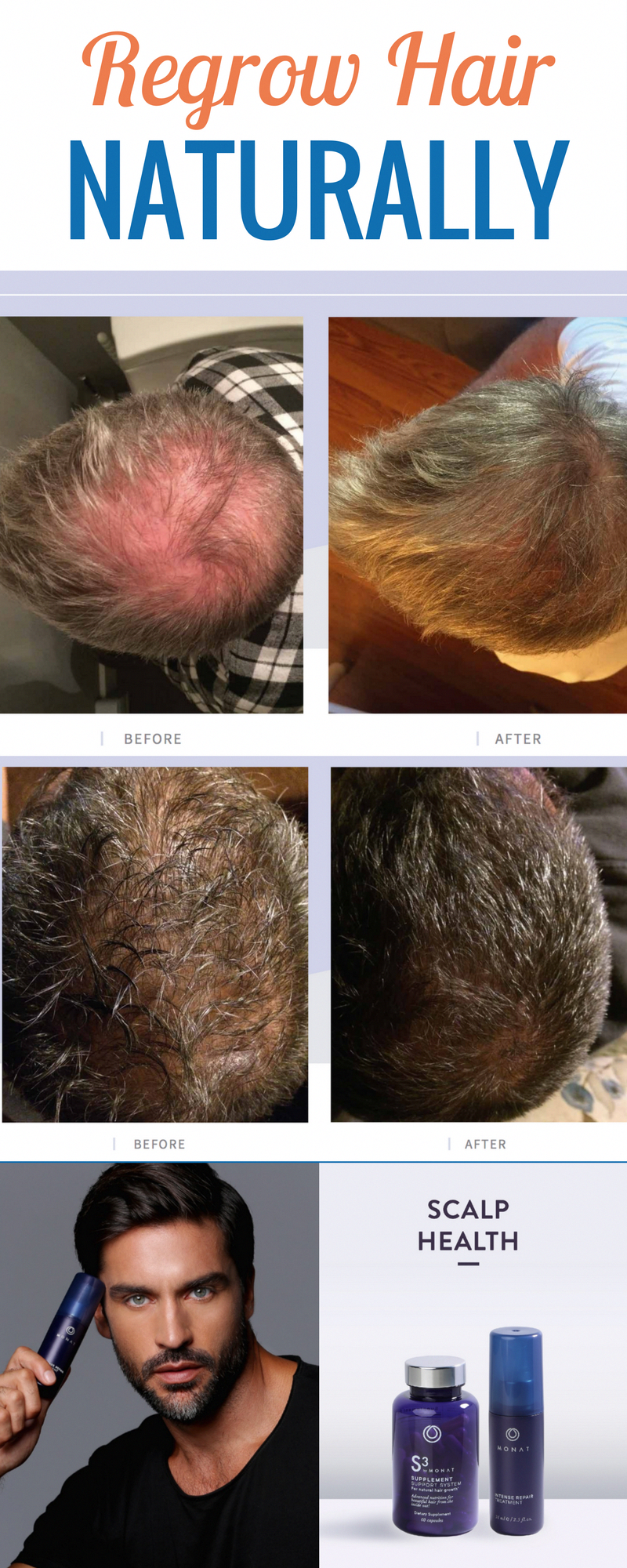 Mix These 3 Ingredients To Regrow Thick, Strong Hair In No Time! -   12 hair Growth for men ideas