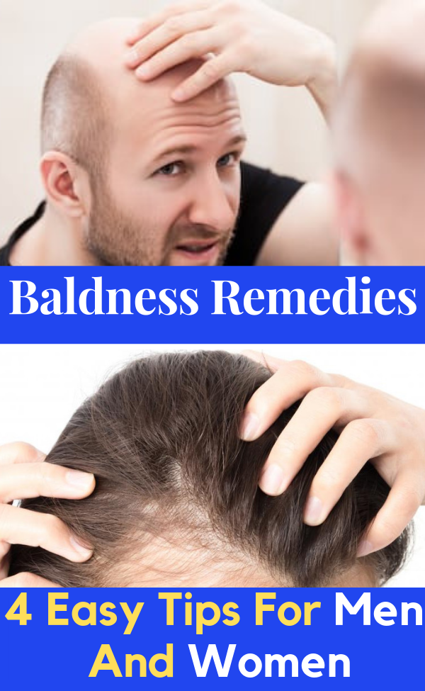 Baldness Remedies - 4 Easy Tips For Men And Women! -   12 hair Growth for men ideas