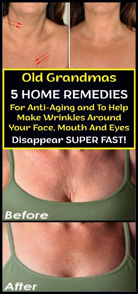 Old Grandmas 5 Home Remedies For Anti-Aging and To Help Make Wrinkles Around Your Face, Mouth And Eyes Disappear Super Fast -   13 skin care Homemade remedies ideas