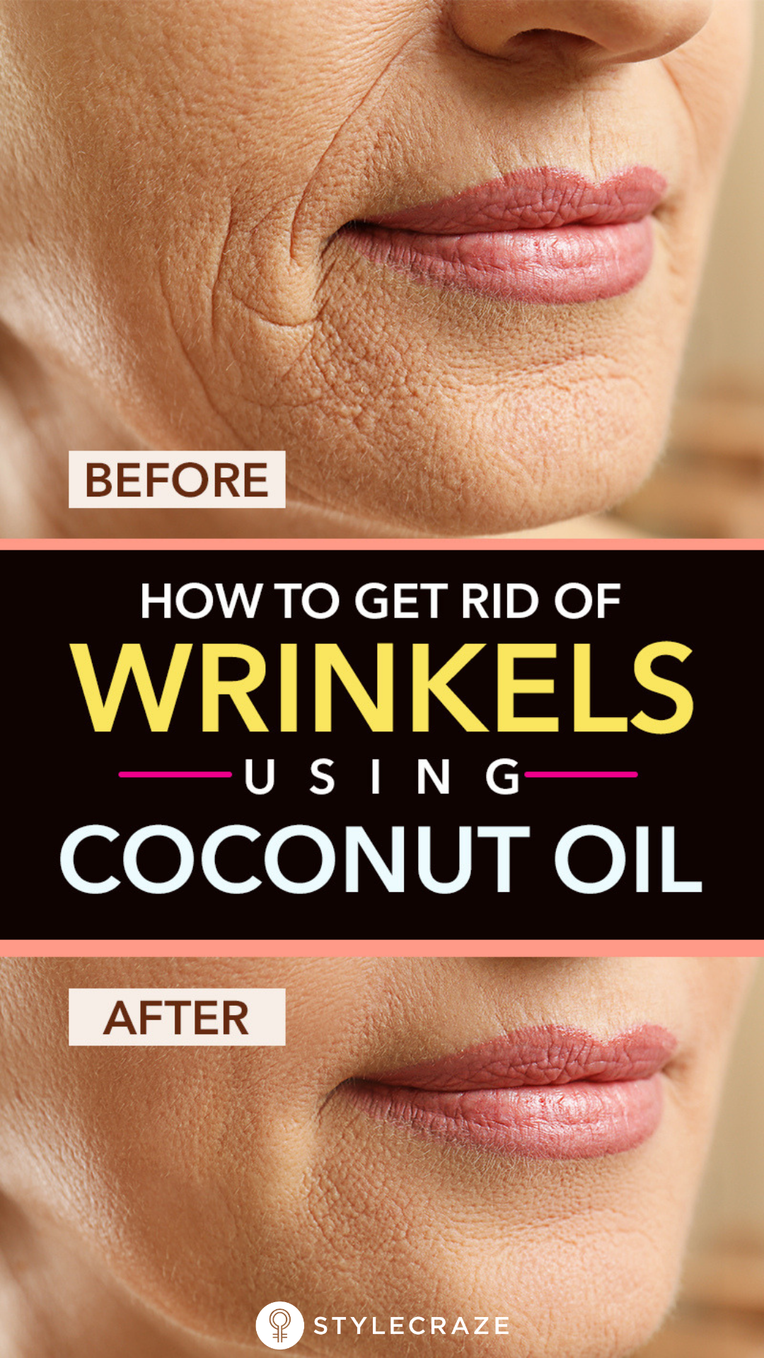 How To Get Rid Of Wrinkles Using Coconut Oil -   13 skin care Homemade remedies ideas