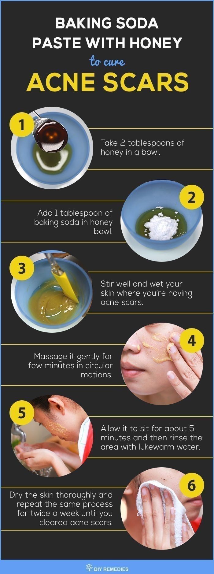 4 Natural Treatments to Clear Acne Scars -   13 skin care Homemade remedies ideas