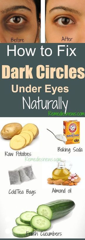 How to Fix Dark Circles Under Eyes Naturally at Home -   18 makeup Beauty remedies ideas