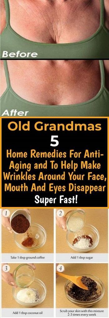 OLD GRANDMAS 5 HOME REMEDIES FOR ANTI-AGING AND TO HELP MAKE WRINKLES AROUND YOUR FACE, MOUTH AND EYES DISAPPEAR SUPER FAST -   18 makeup Beauty remedies ideas