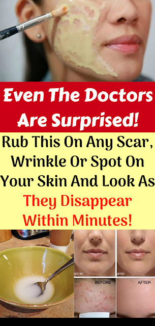Rub This On Any Scar, Wrinkle Or Spot On Your Skin And Look As They Disappear Within Minutes! Even The Doctors Are Surprised! -   18 makeup Beauty remedies ideas