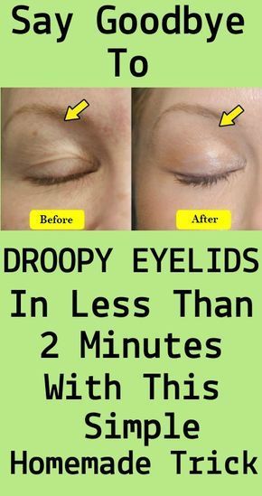 Say Goodbye To Droopy Eyelids In Less Than 2 Minutes With This Simple Homemade Trick -   18 makeup Beauty remedies ideas
