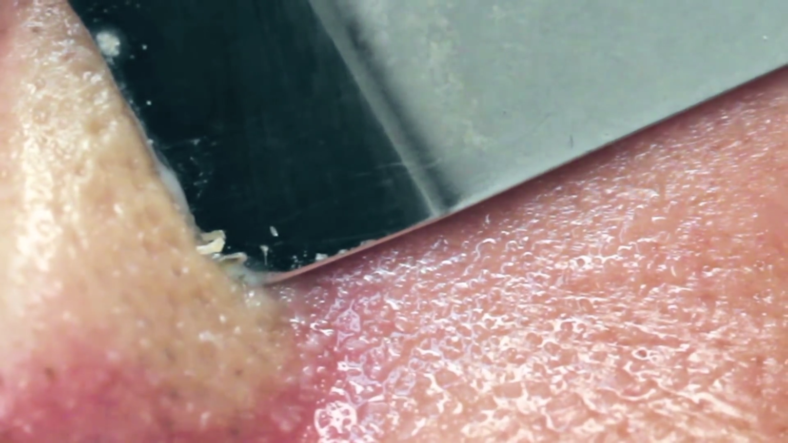 Ultrasonic Exfoliating Skin Scrubber -   23 skin care Videos pasos ideas