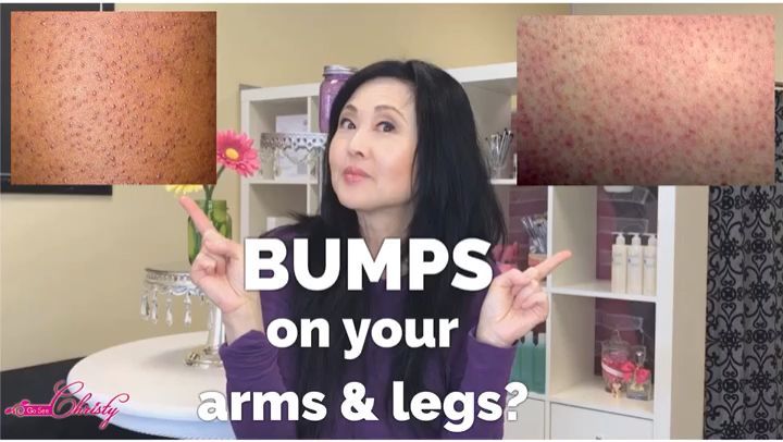 Smooth Bumpy Skin in Your Arms & Legs -   23 skin care Videos pasos ideas