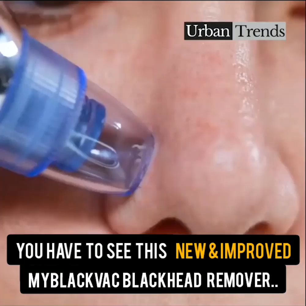 Blackhead Removal Vacuum MYBLACKVAC INC.в„ў - Easiest & painless way to get rid of Black & Whiteheads -   12 skin care Body tips ideas