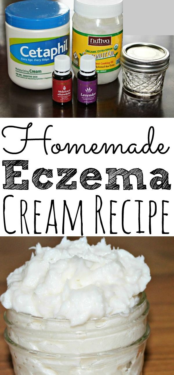 Homemade Eczema Cream With Essential OIls? -   16 hair Natural homemade recipe ideas